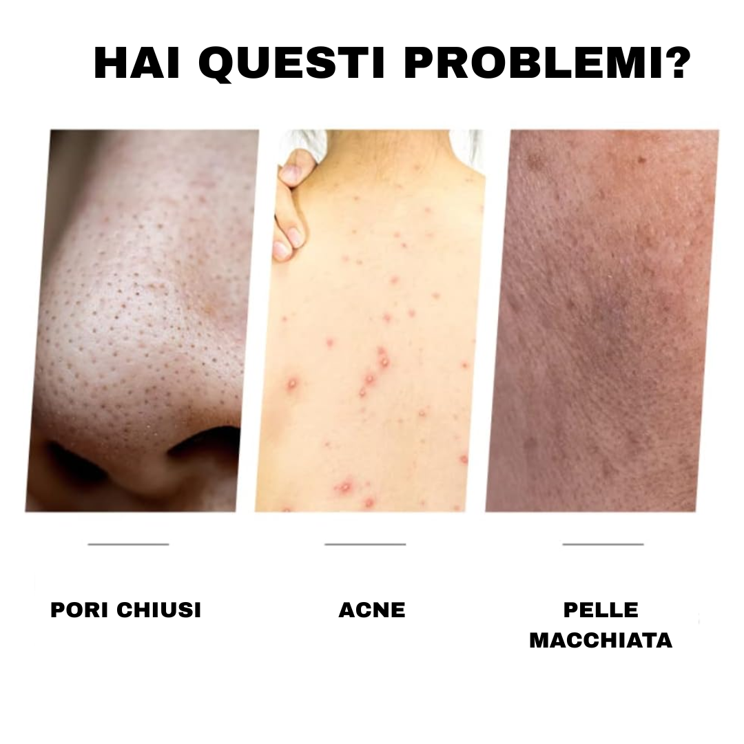 Sapone alla curcuma